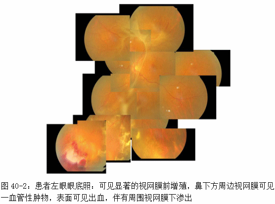 ZY016_218_2.gif